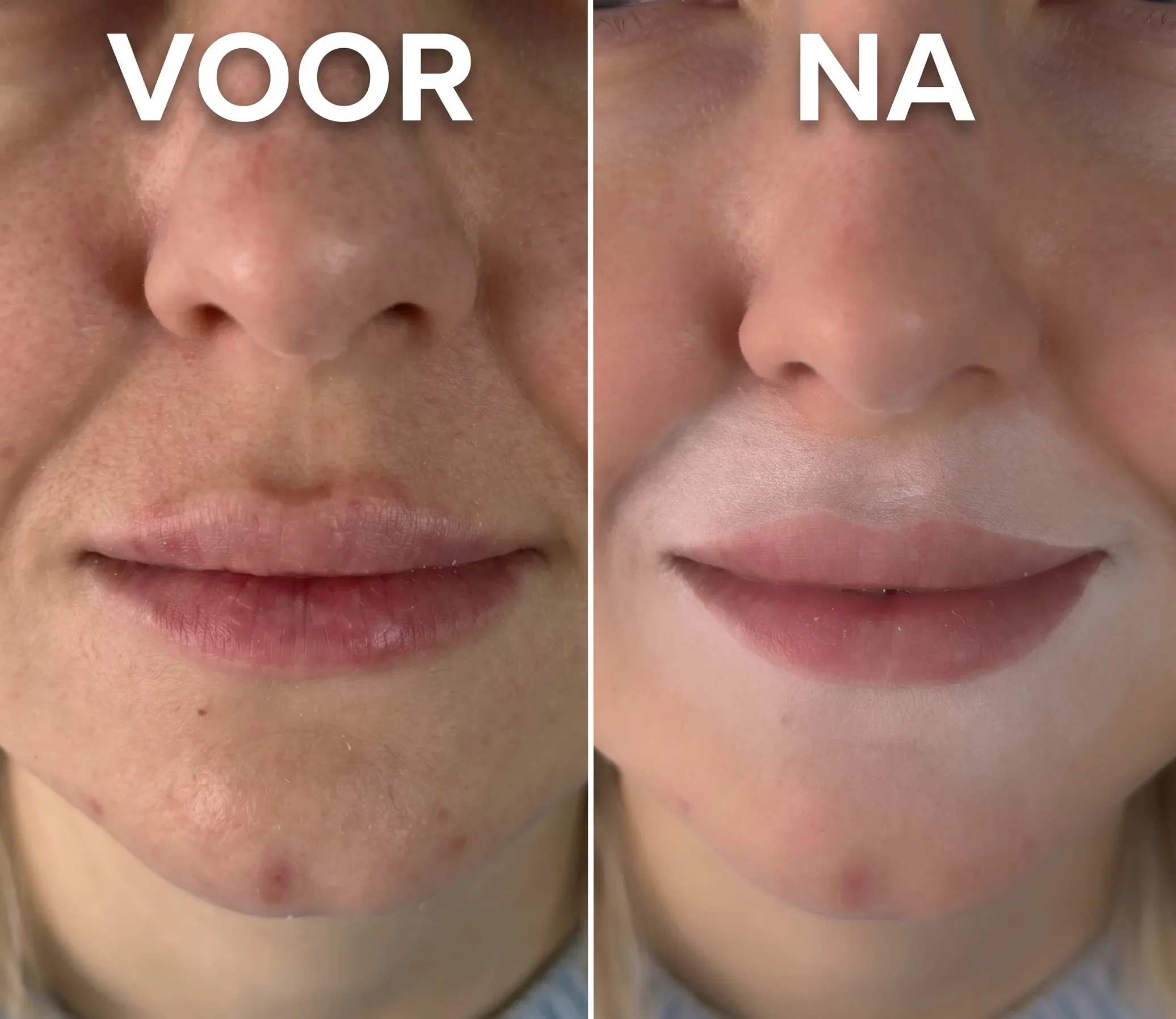 Resultaat PMU Lipblush